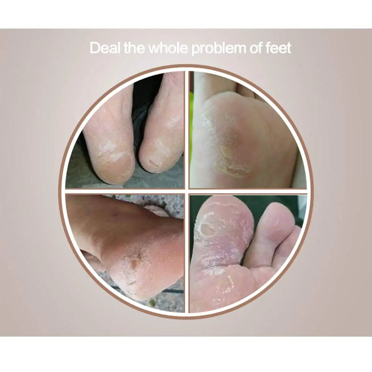 

Electric Foot File Grinder Dead Skin Callus Remover for Foot Pedicure Tools Feet Care for Hard Cracked Foot Files Clean Tools