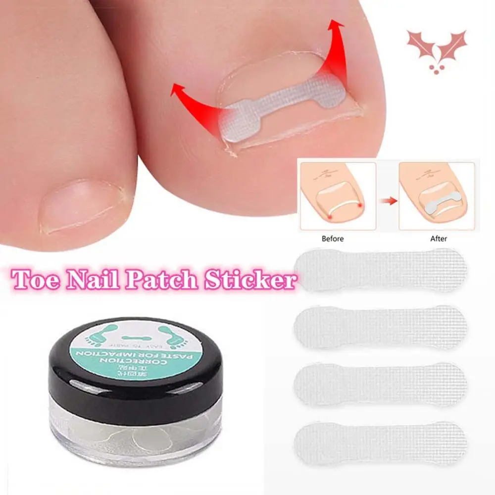 

10pcs/set Useful Girls Ingrown Nail Orthotic Nail Light Portable Heavy Pedicure Tools Correction Sticker