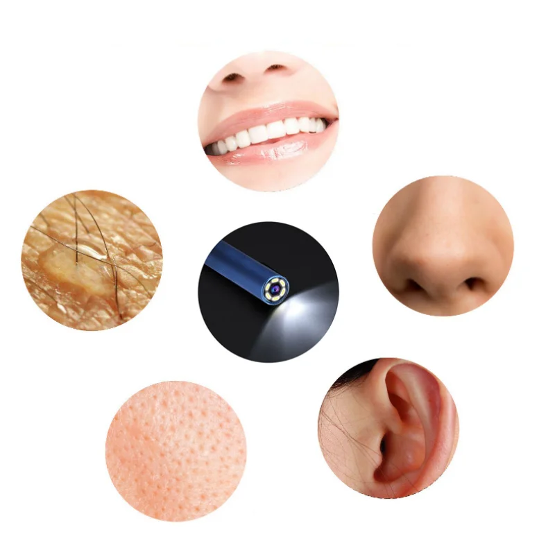 3 в 1 инструмент для удаления ушного воска USB отоскоп-Ушная камера ушной чистки