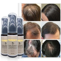 20ml hair growth serum essence for women and men anti preventing hair loss alopecia liquid damaged hair repair growing faster