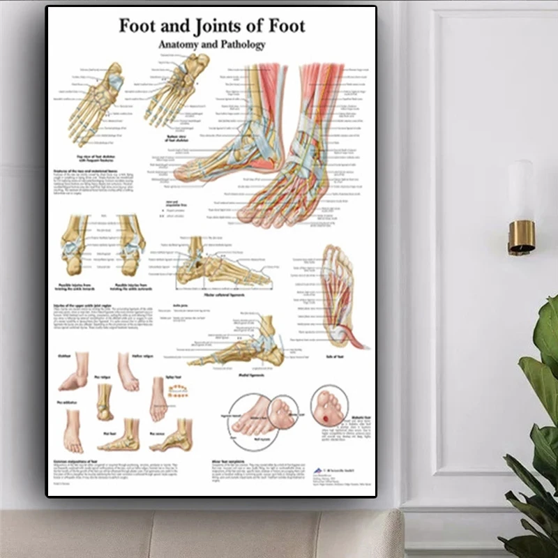 Картина на холсте с изображением акупунктуры