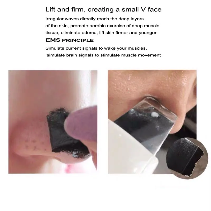 Ультразвуковой аппарат для чистки кожи лица глубокий массажер ультразвуковой