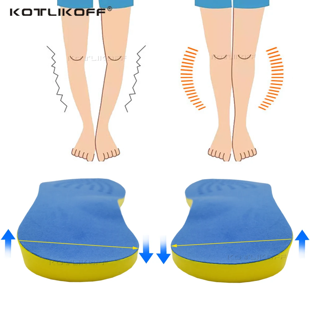Orthopedic Insoles For Feet Corrective O Type Leg Inserts Foot Alignment Knock Knee Pain Bow Legs Valgus Varus Pad | Обувь