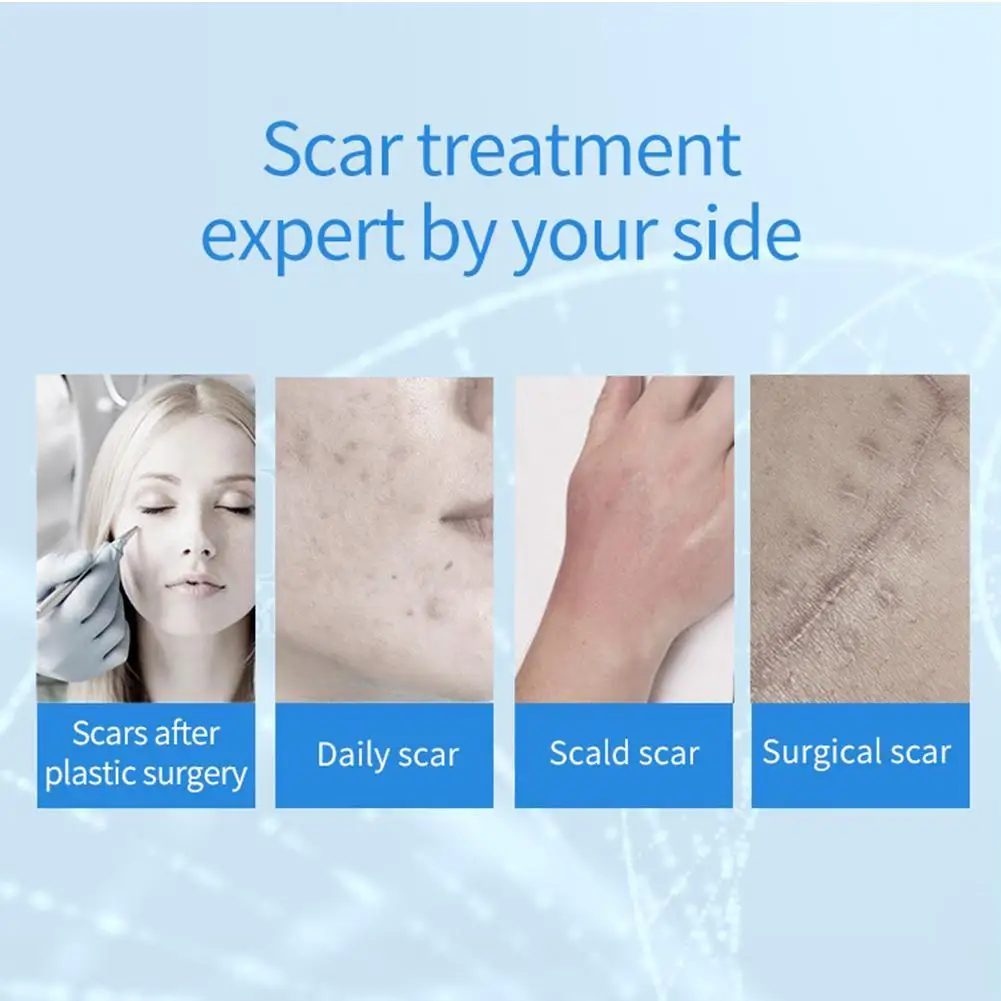 Крем для удаления шрамов от акне гель прыщи растяжки ожоги крем разглаживающий