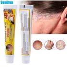 Sumifun травяной крем от псориаза, бактериостаз, экзема, дерматита, противовоспалительный крем от псориаза, мазь против псориаза, 1 шт.