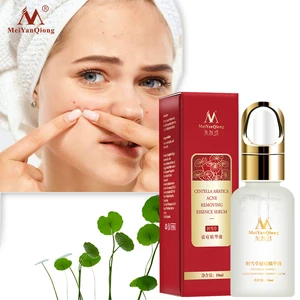 Сыворотка для удаления акне Centella азиатская Сыворотка для удаления акне для устранения следов от акне и контроля жирности для улучшения отбеливания кожи