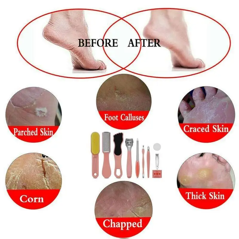 

10 Pcs Foot Care pedicure tools set professional foot Rasp scrubber nail Remove Scraper Hard Skin manicure Dead tools file P4B0