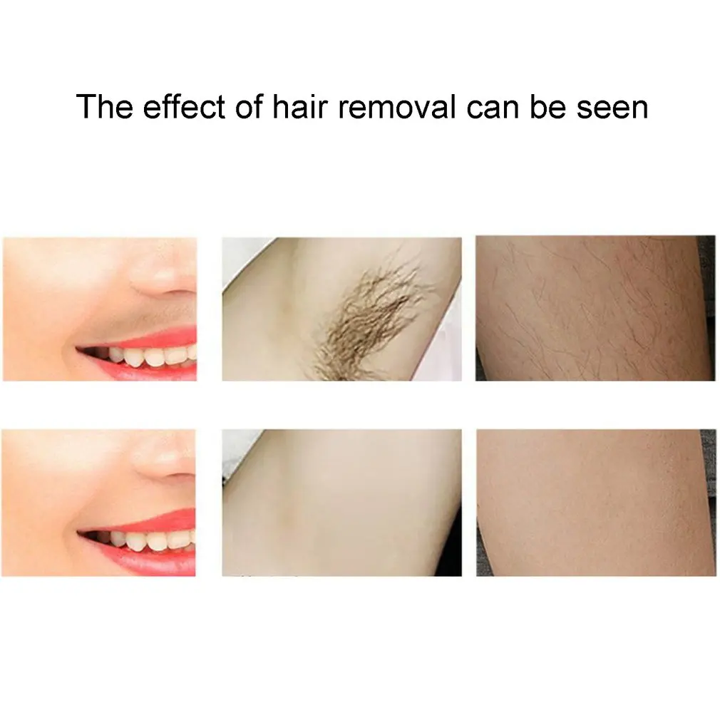 

Personal Care Appliances