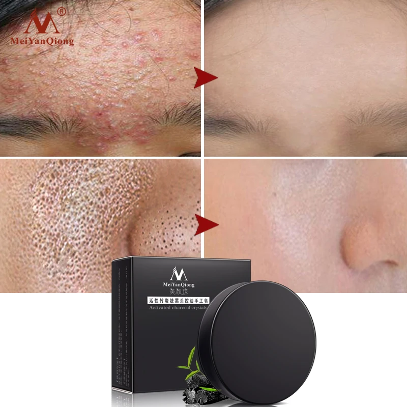 Активированный уголь кристаллы мыло ручной работы отбеливание кожи лица Мыло