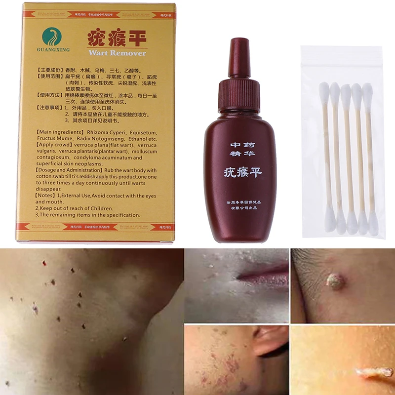 

Body Warts Treatment Cream Skin Tag Remover Foot Corn Removal Plantar Genital Warts Ointment Foot Care Cream 12ml