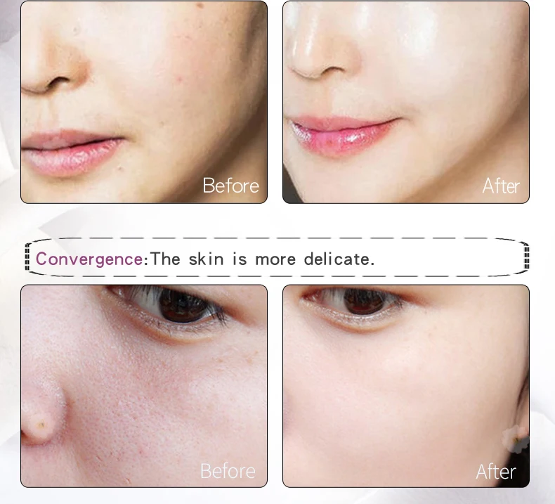 10 шт. эмульсия для ухода за кожей лица с гиалуроновой мангой | Красота и здоровье