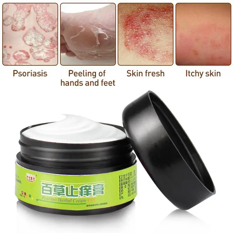 

25g Natural Herbal Ointment Psoriasi Cream Effective for Dermatitis Psoriasis Eczema Cream Chinese Herbal Medicine