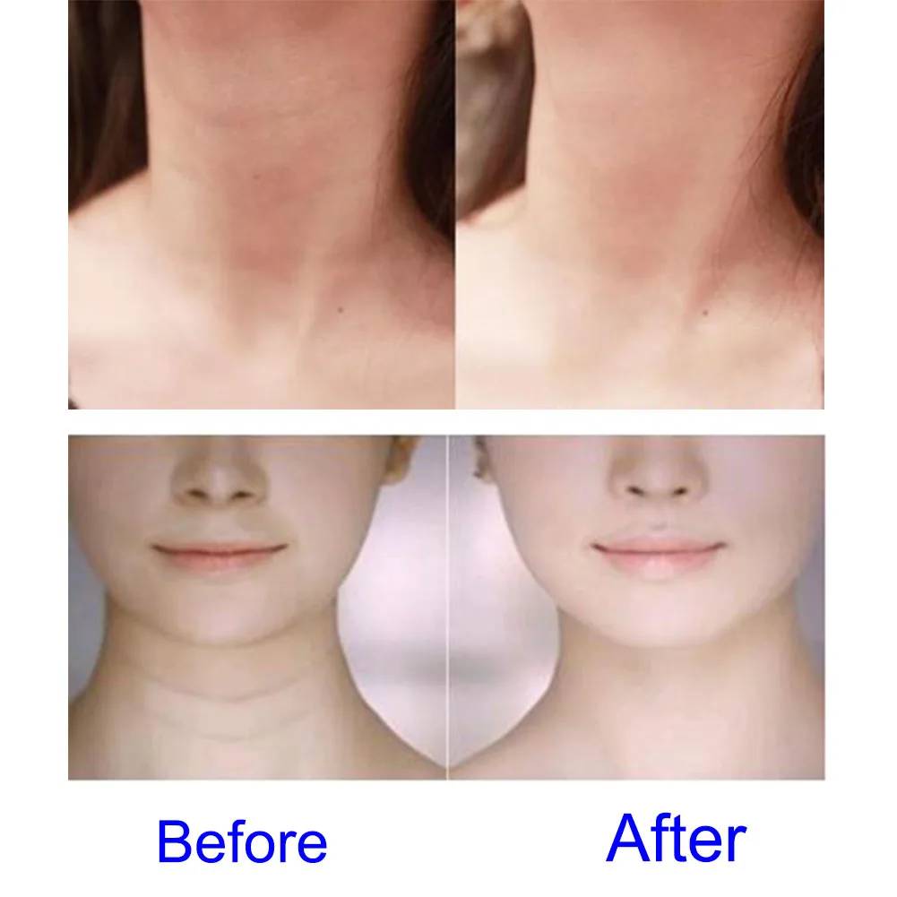

Neck Care Pad Silicone Anti Wrinkle Aging Reusable Transparent Pads NShopping