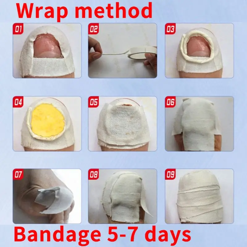 Противогрибковая эссенция из трав для лечения грибка ногтей | Красота и здоровье