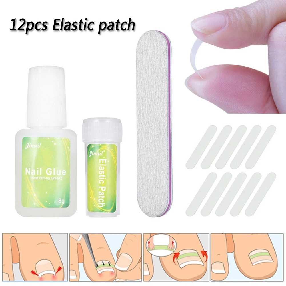 10 шт./бутылка инструмент для коррекции вросших ногтей | Красота и здоровье