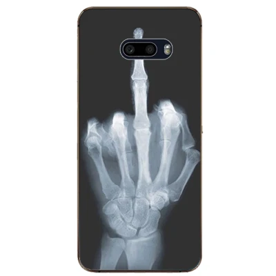 Для LG V50S ThinQ LM-V510N чехол 6 4 дюйма Роскошный из ТПУ и силикона s для V 50 S V50 задняя