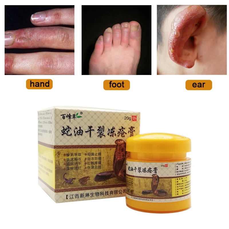 20G Winter Essential Snake Oil Anti-Chapping Dry Crack Treat Frostbite Hand Itching Redness Moisturizer Repair Skin Ointment | Красота и