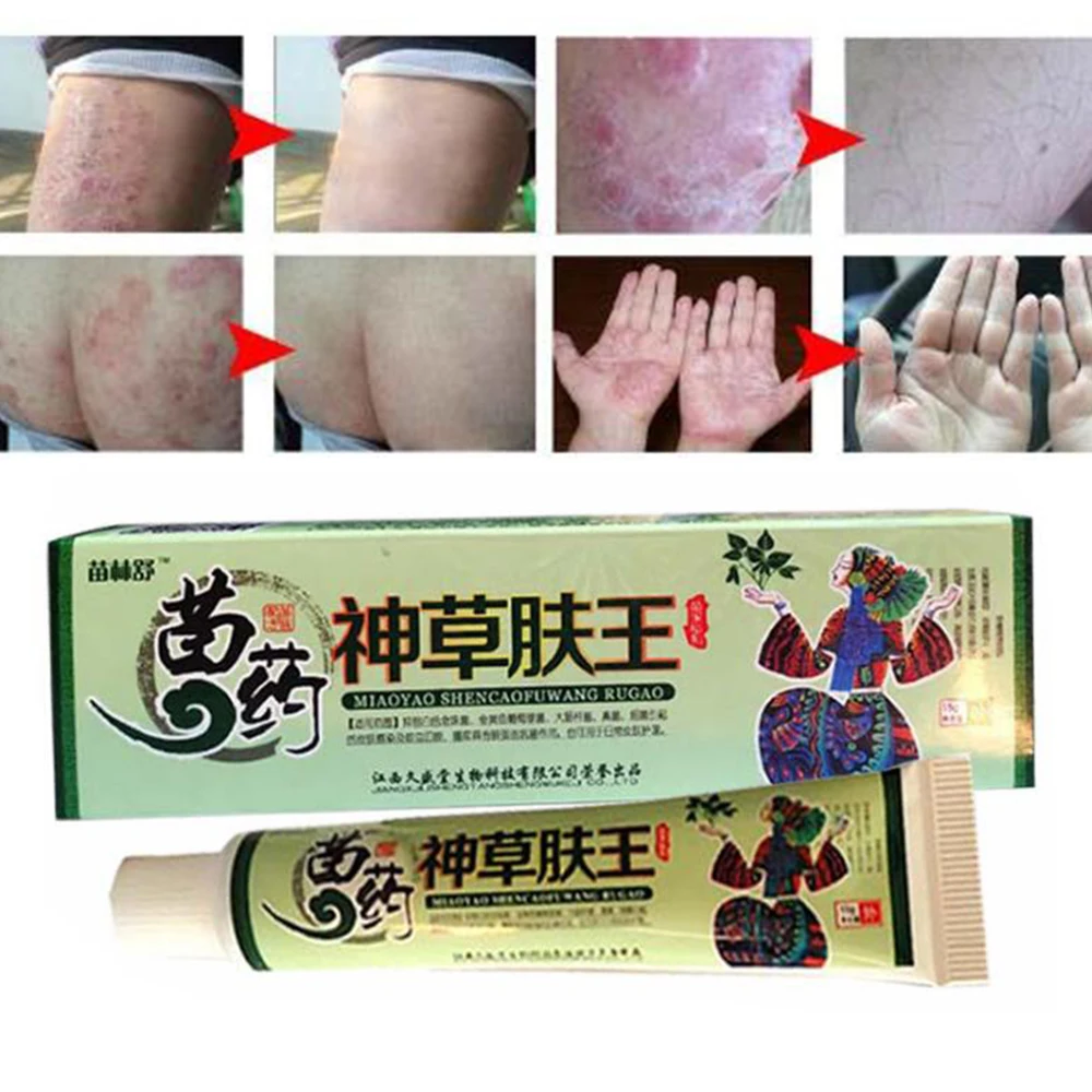 

100% Natural Herbal Creams Body Psoriasis Cream Perfect For Dermatitis and Eczema Pruritus Psoriasis Skin Problem Plaster