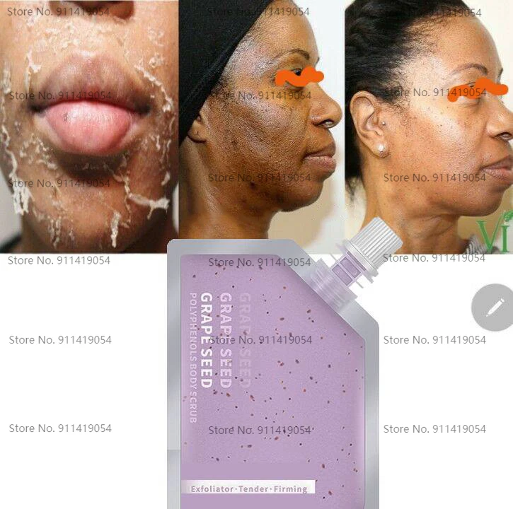 

100g Grape Pip Peeling Facial Skin Scrub Skin Peel To Remove Darkness for Whitening Skin