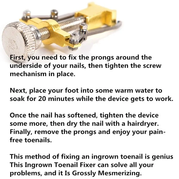 Инструмент для поднятия вросших пальцев ног | Красота и здоровье