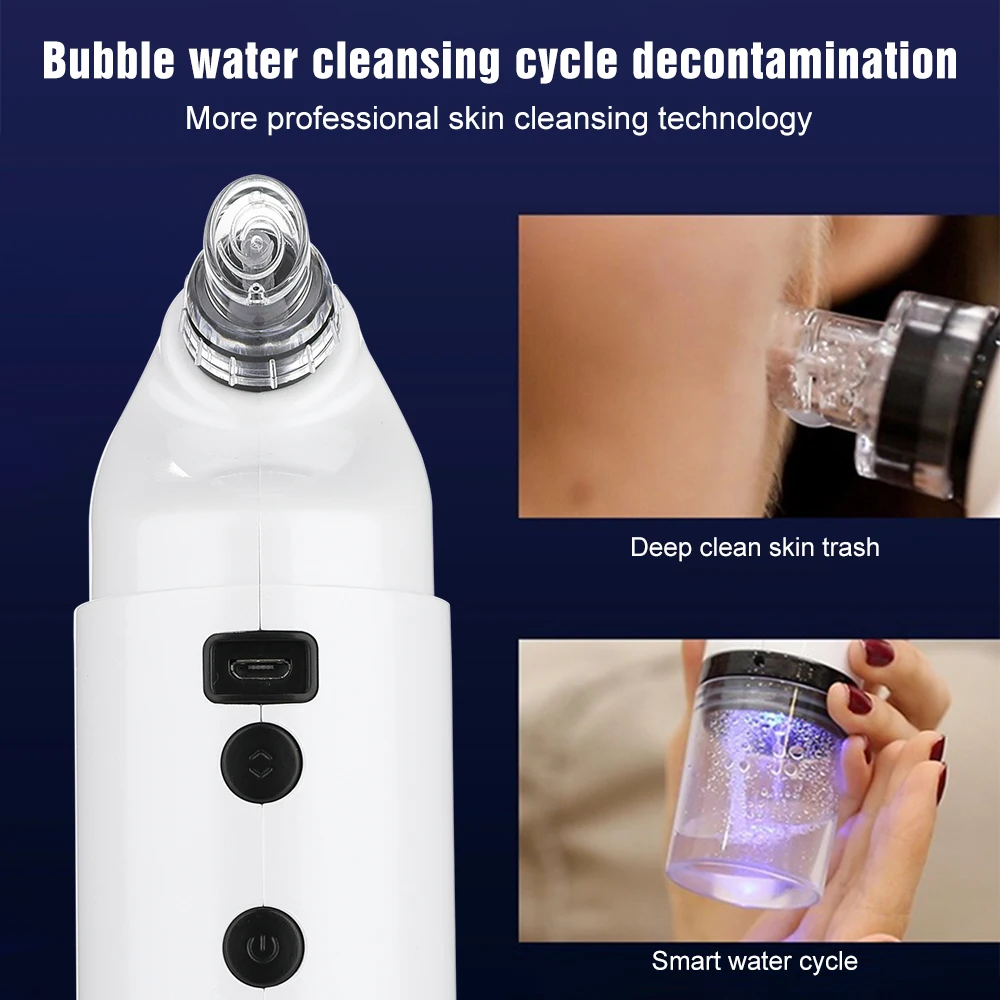 Аппарат для удаления чёрных точек со светодиодсветильник | Красота и здоровье