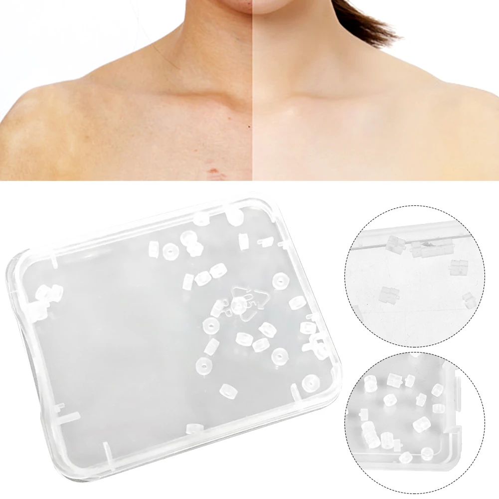 

30pcs/box Painless Skin Tag Remover Exfoliating Scrub Mole Home Warts Treatment Rubber Bands Body Acne Non Toxic Face Care Nevus