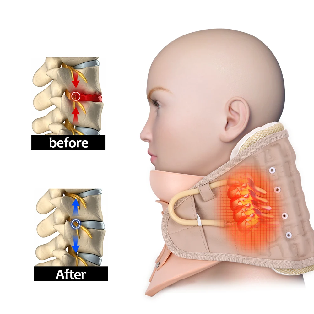 Надувной шейный массажер OLIECO портативный для облегчения боли в шее