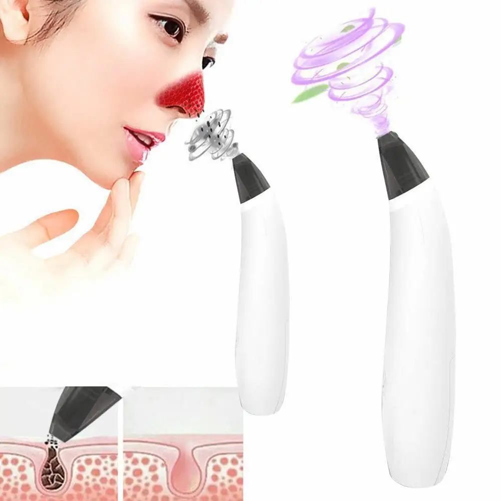 Вакуумное средство для удаления угрей всасывающее пилинга акне очищающее поры