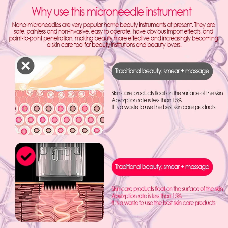 MYM Microneedling Ручка Электрический микро винт иглы картридж крошечные беспроводной