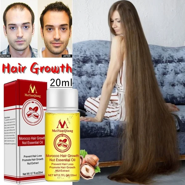 

MeiYanQiong 20ML Fast Powerful Hair Growth Essence Hair Loss Products Essential Oil Liquid Treatment Preventing Hair Loss Hair