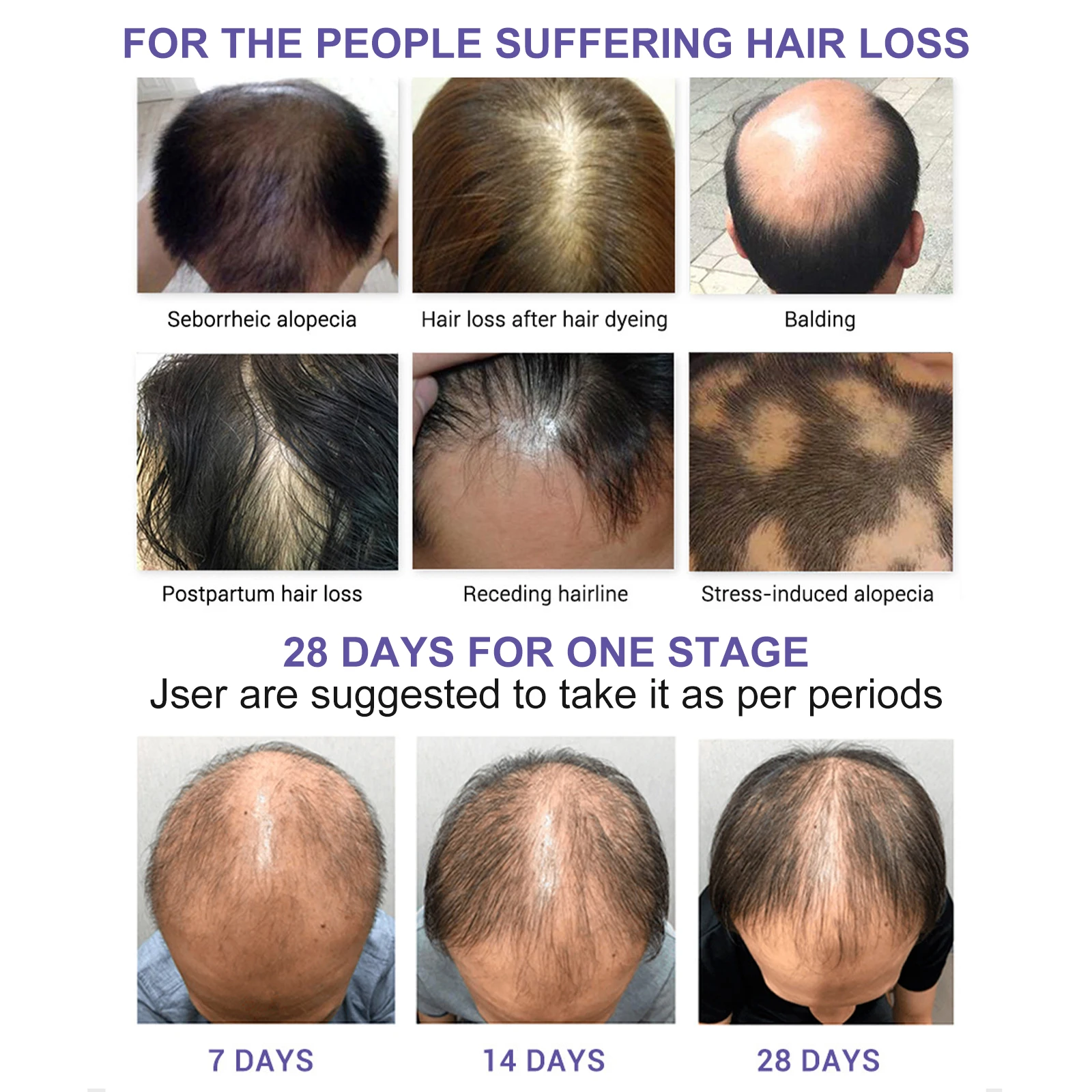 

Fast Hair Growth And Hair Care Serum Oil Prevent Hair Loss Deep Nourishing Repair Damaged Hair Conditioner