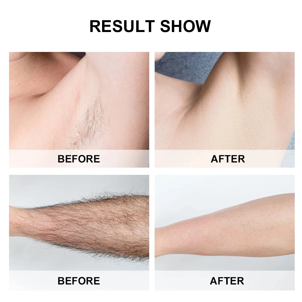 

500,000 Flashes Epilator Hair Removal Laser Machine for Arm Leg Bikini Armpit Professional Painless Laser for Hair Removal