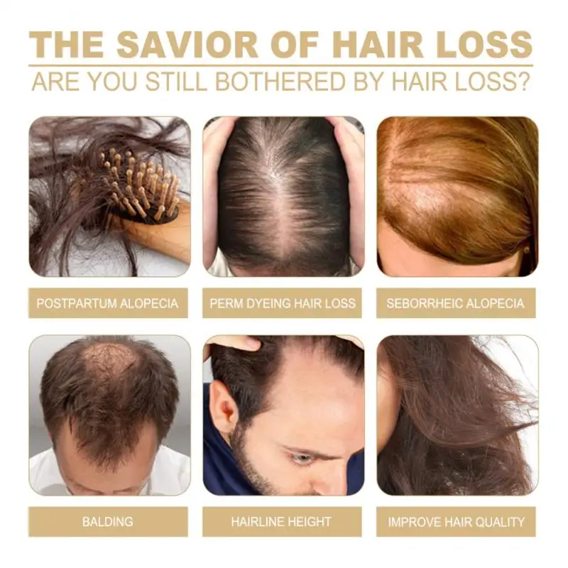 Маска для волос с имбирем корней кожи головы 60 мл | Красота и здоровье