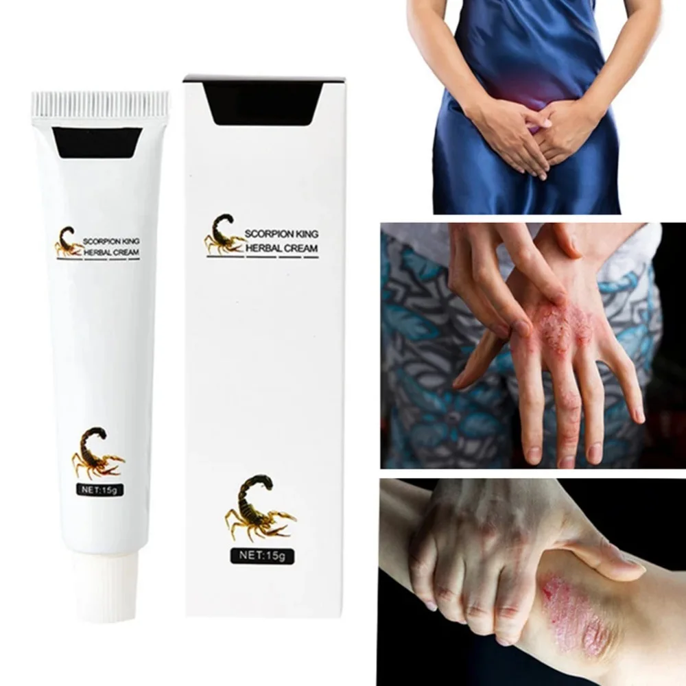 

15g Scorpion Herbal Cream Effective Foot Treatment Cream Anti Fungal Dermatitis Eczematoid Eczema Psoriasis Body Cream