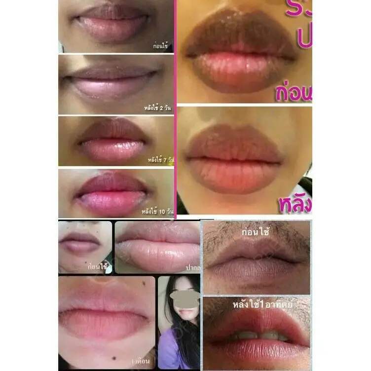 

Pink Natural Lightening Lip Bleaching Treatment Cream Bleach Dark Black Smoke