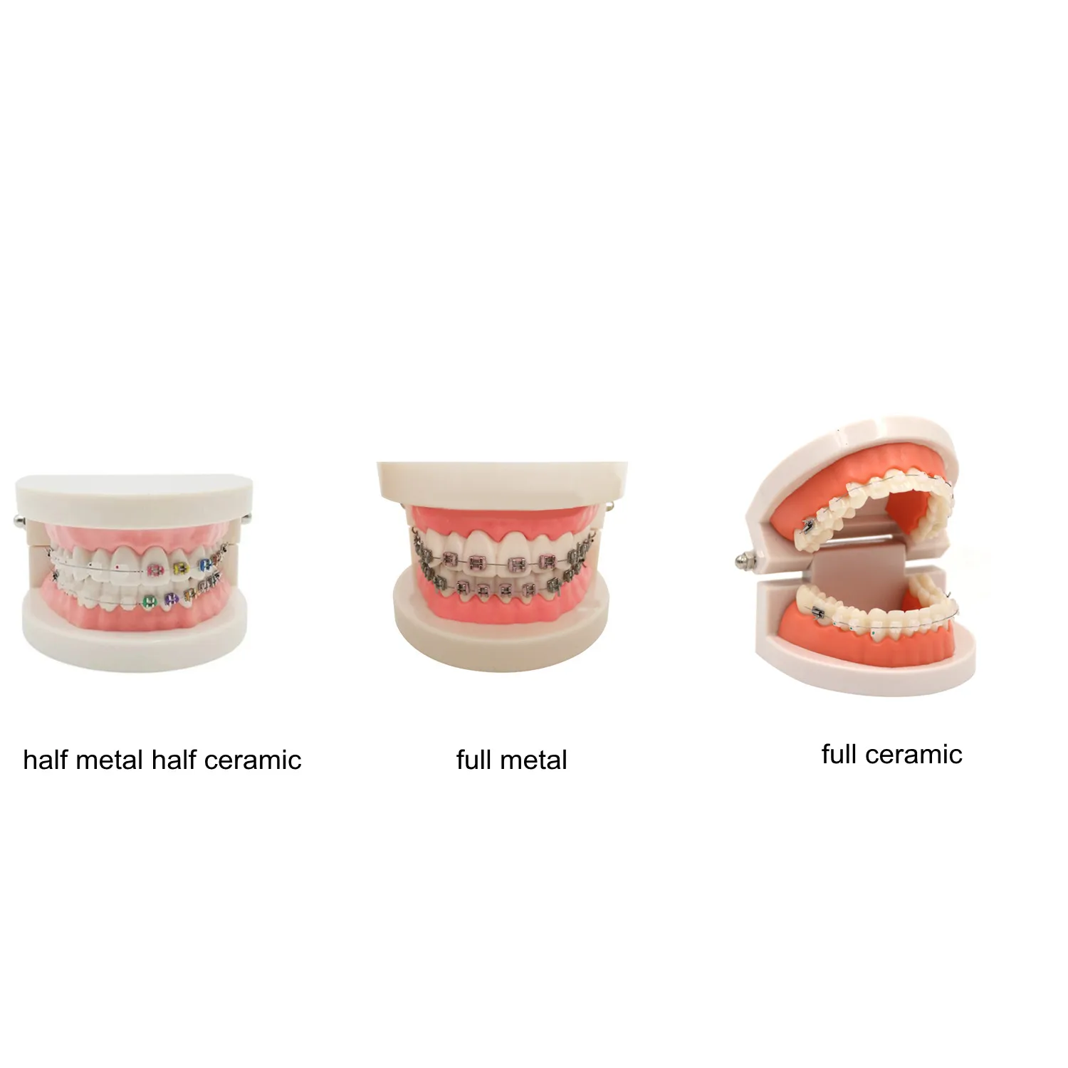 

1pcs Dental Teach Study Orthodontic Teeth Model With Ceramic/Metal Brackets Buccal Tubes Wires For Dentist Clinic