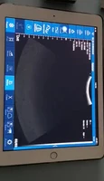 iphone ultrasonic probe color wireless portable wifi ultrasound scanner