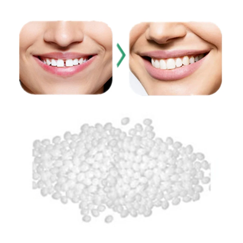 10/20g Temporary Tooth Replacement Material Tooth Filling Temp Replace Missing Denture Adhesive DIY Teeth Repair Dental