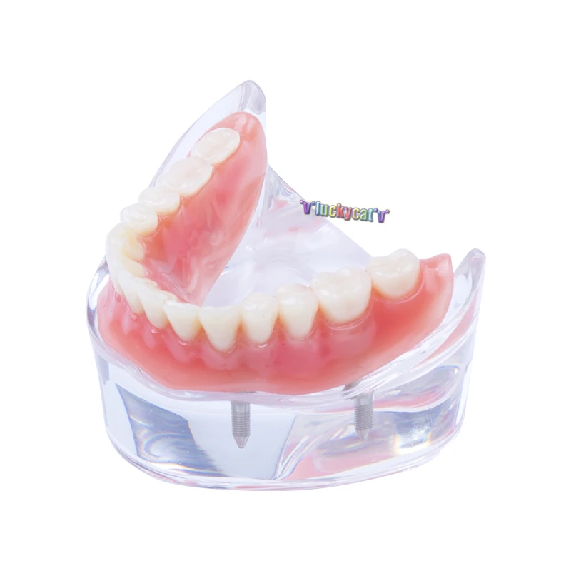 Модель зубного протеза съемная внутренняя модель нижних зубов Mandibular с