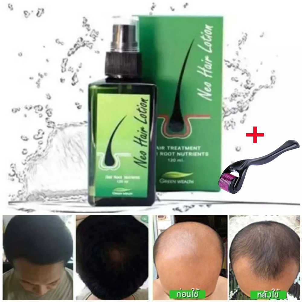 Neo-loción para el cabello, tratamiento para el cabello, raíz del cabello, antipérdida, Barba, rebrote Original de Tailandia, 120ml