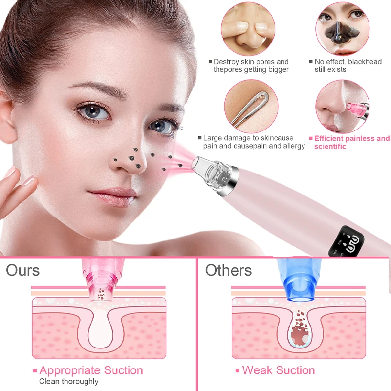 

Electric Facial Pore Cleaner Exfoliator Face Blackhead Remover Acne Vacuum Deep Cleansing Skin Care Beauty Facial Cleaner