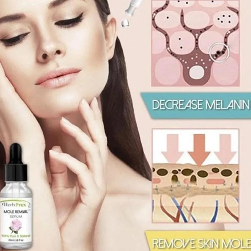 

20mL Liquid Wart Mole Removal Serum Organic Tags Solutions Serum Skin Tag Mole Freckle Spot Fast Remover Essence Skin Care