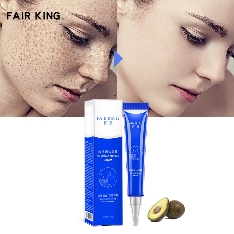 

2021 New Strong Effects Powerful Whitening Freckle Cream 20g Remove Melasma Acne Spots Pigment Melanin Face Care Cream