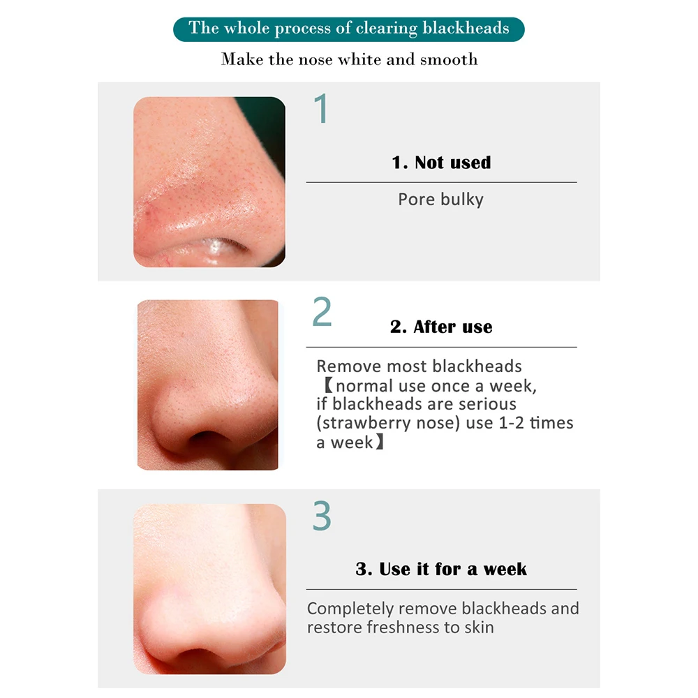 FTEENPLY маска для лица Сыворотки удаления черных точек носа что обеспечивает