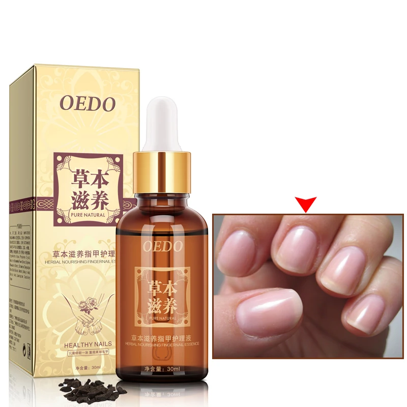 

Травяное Лечение ногтей от грибков эфирное масло Отбеливание рук и ног удаление грибка ногтей инфекция Уход за ногами лак для ногтей