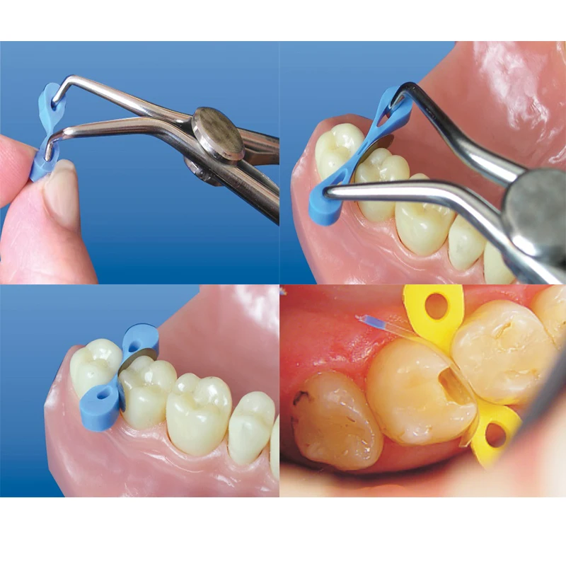 

Dental Transparent Matrices 30pcs/box Sectional Contoured Dental Matrices Polyester Matrix Pre-shaped Dental Restoration Matrice