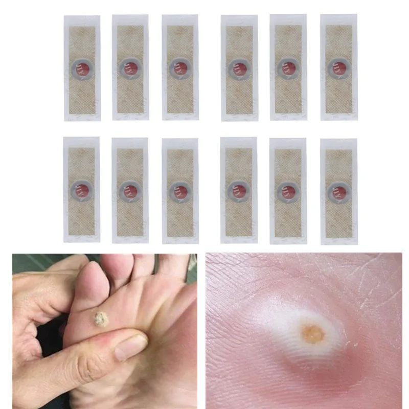12 шт. медицинский пластырь для ног кукурузы удаления бородавки шип Пластырь от