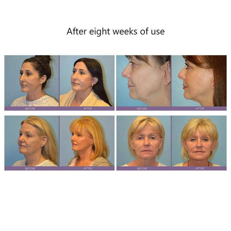 

Face Lifting Machine Facial Microcurrent Face Massager Skin Tightening Rejuvenation Wrinkle Removal Device Beauty Massage Care