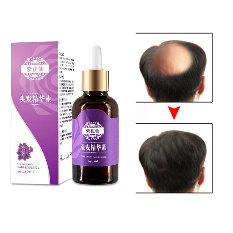 Средство от выпадения волос натуральное | Красота и здоровье