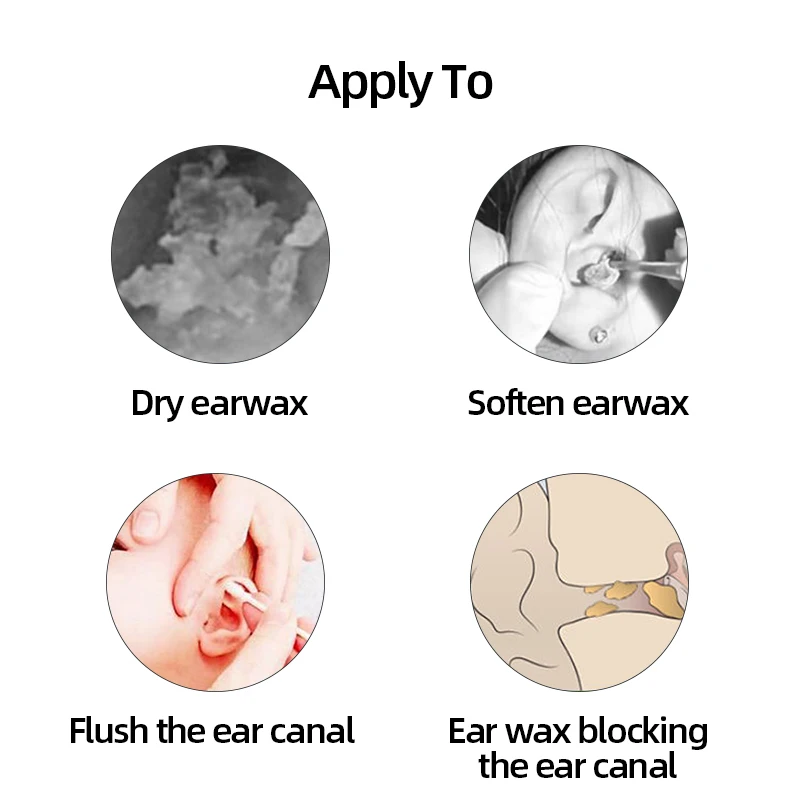 Капли для ушей 10 мл бикарбонат натрия фрикарбонат жидкость лечения острого и